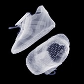 Baby shoes, X-ray