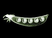 Peas in a pod with skeletons, X-ray