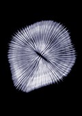 Coral, X-ray