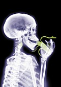 Person eating a banana, X-ray
