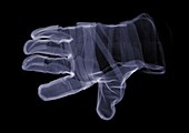 Single glove, X-ray