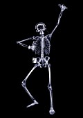 Person dancing with glow stick, X-ray
