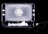 Wide screen television, X-ray
