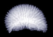 Brain coral, X-ray