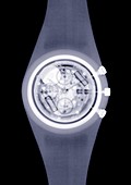 Wristwatch, X-ray
