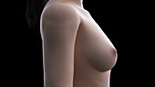Female breast implant