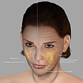 Skin aging, illustration