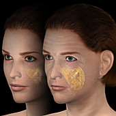 Skin aging, illustration