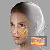 Skin aging, illustration