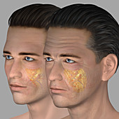 Skin aging, illustration