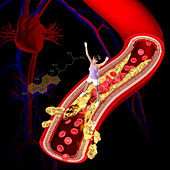 Cholesterol, illustration