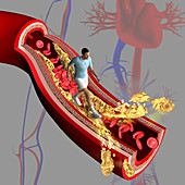 Cholesterol, illustration