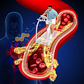 Cholesterol, illustration