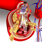 Cholesterol, illustration