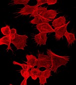 Apoptotic cancer cells cytoskeleton, light micrograph
