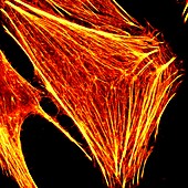 Cancer cell super resolution actin, light micrograph