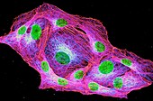 Osteosarcoma Cells cytoskeleton and nuclei, light micrograph