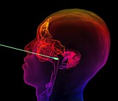 Nasopharyngeal Covid-19 test, 3D CT scan