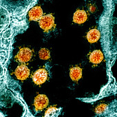 Covid-19 coronavirus particles, TEM