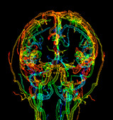 Head blood vessels, 3D CT angiogram