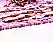 Choroid layer, light micrograph