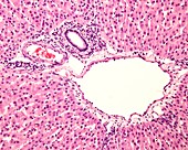 Liver portal area, light micrograph