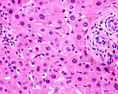 Polyploid liver cells, light micrograph