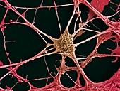 Neurone, SEM