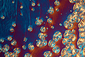 Sucrose and zinc sulphate, polarised light micrograph