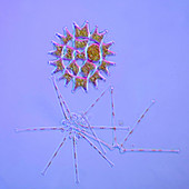 Algae, polarised light micrograph