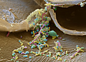 Sauerkraut bacteria, SEM