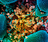 Cell infected with Covid-19 coronavirus particles, SEM