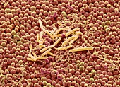 Bacteria from a human beard, SEM