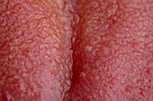 Surface of a tongue