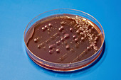 Bacterial colonies on agar plate