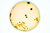 Bacterial colonies on agar plate