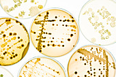Bacterial colonies on agar plates