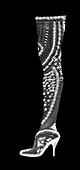Bejewelled stockinged high heeled shoe, X-ray