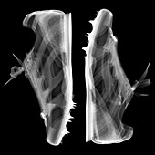 Running shoes with spikes, X-ray