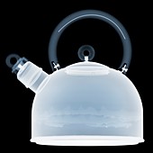 Kettle, X-ray