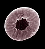 Sea urchin, X-ray