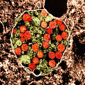 Cell infected with Covid-19 coronavirus particles, TEM