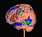 Brain activity during a visual language task, fMRI scan