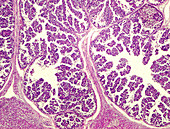 Liver infected with coccidiosis, light micrograph