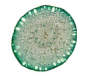 Lemon fruit cross-section, light micrograph