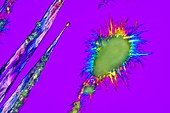 Urea crystals, light micrograph