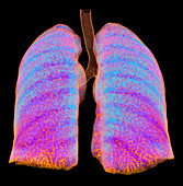 Aeration pattern in healthy lungs, 3D CT scan