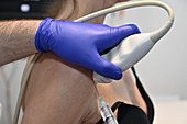 Ultrasound guided steroid injection