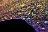 Common duckweed leaf, polarised light micrograph