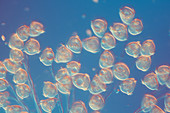 Vorticella peritrich, light micrograph